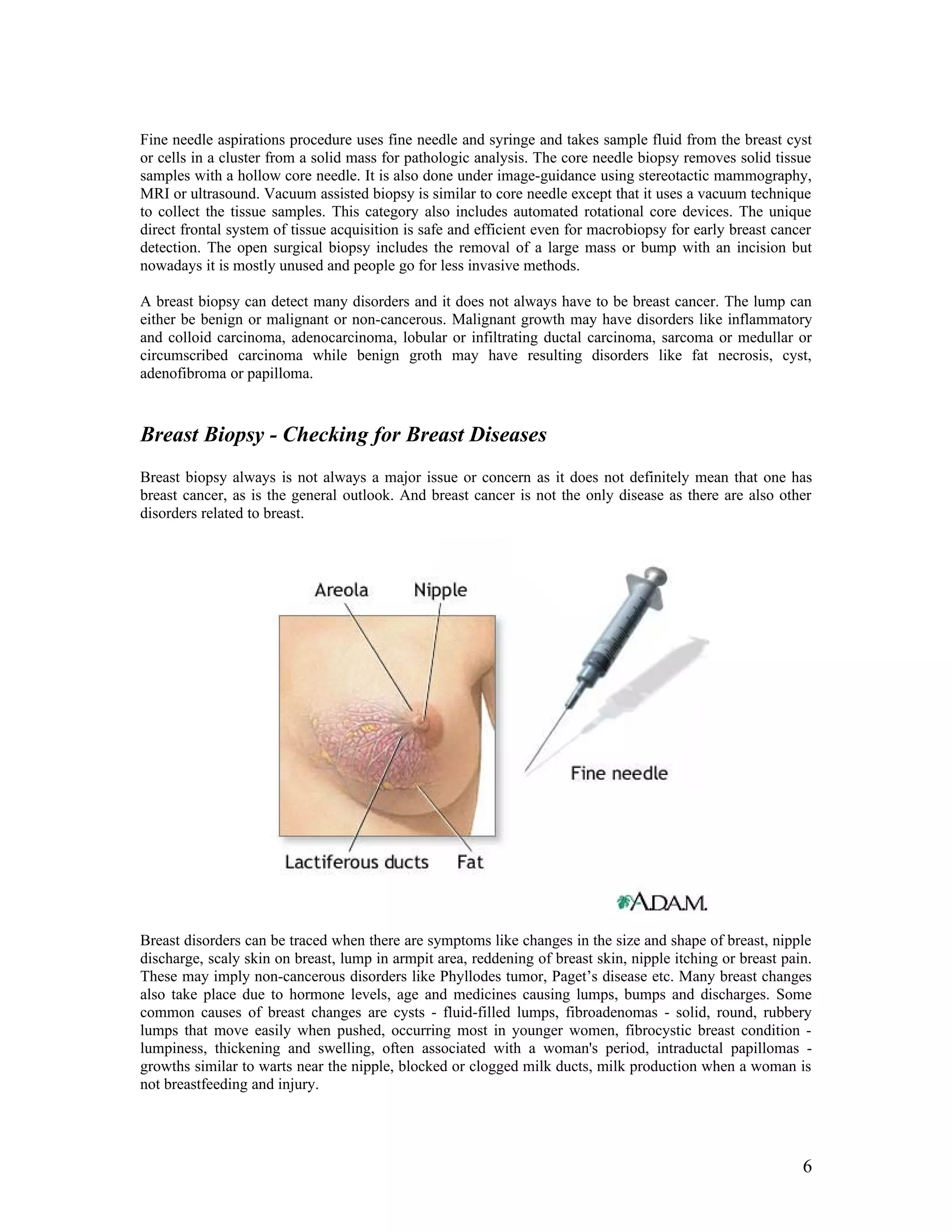 Information about Breast Biopsy | DOC