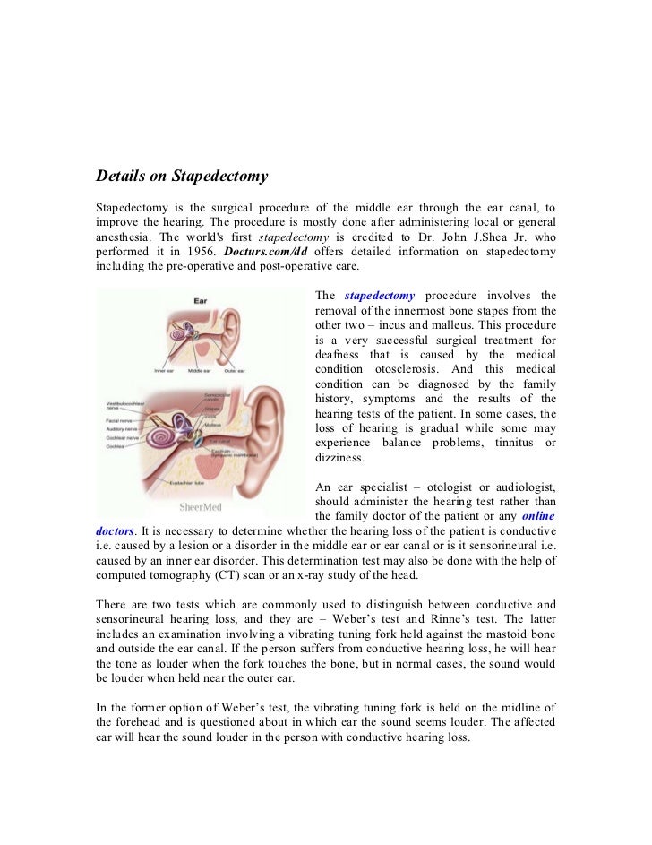 Information about stapedectomy and otoscopy