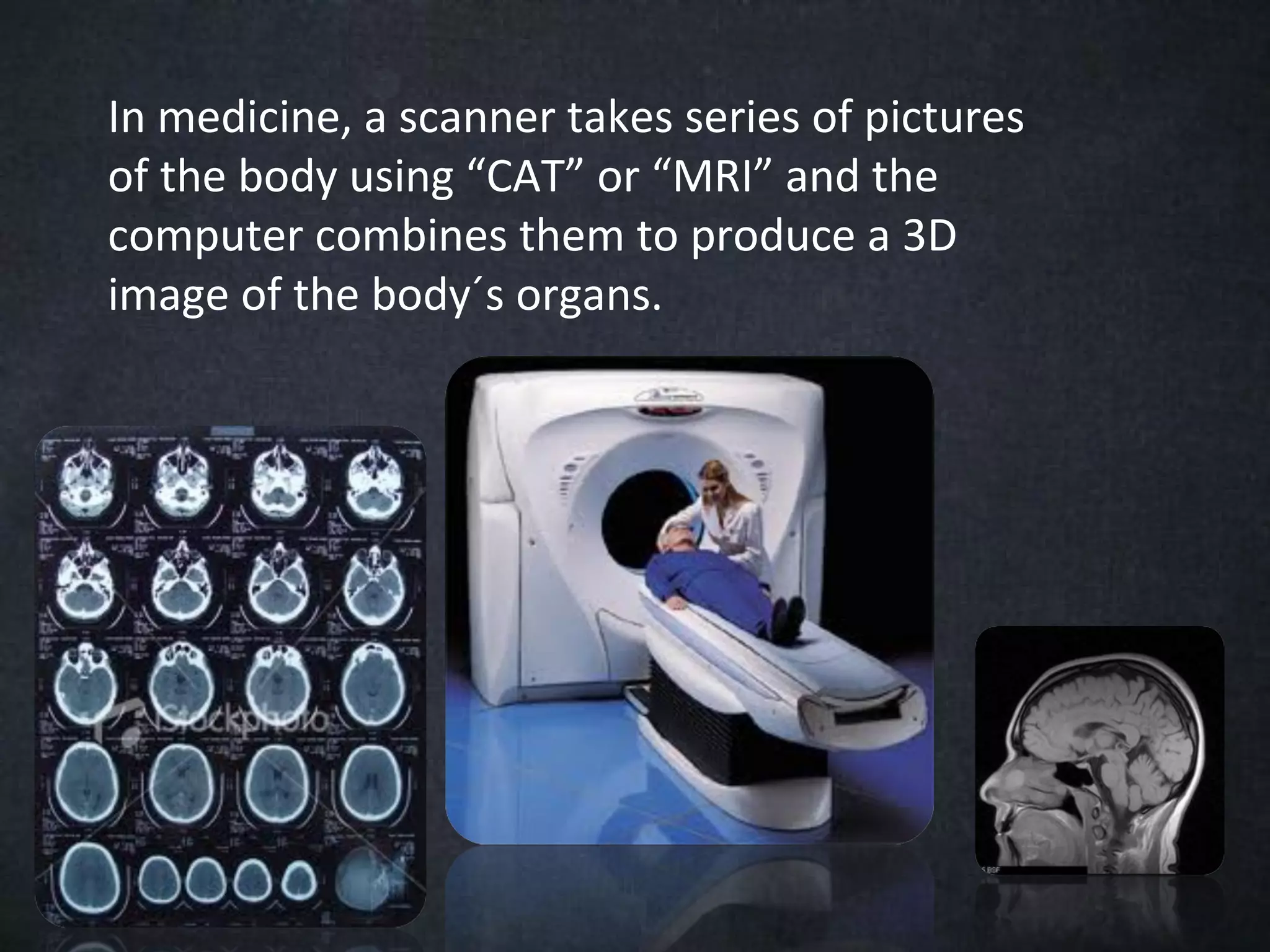 In medicine, a scanner takes series of pictures
of the body using “CAT” or “MRI” and the
computer combines them to produce a 3D
image of the body´s organs.
 