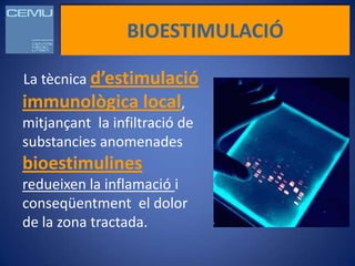 BIOESTIMULACIÓ

La tècnica d’estimulació
immunològica local,
mitjançant la infiltració de
substancies anomenades
bioestimulines
redueixen la inflamació i
conseqüentment el dolor
de la zona tractada.
 