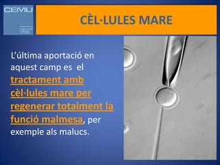 CÈL·LULES MARE

L’última aportació en
aquest camp es el
tractament amb
cèl·lules mare per
regenerar totalment la
funció malmesa, per
exemple als malucs.
 