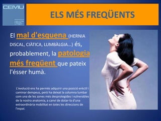 ELS MÉS FREQÜENTS

El mal d'esquena (HERNIA
DISCAL, CIÀTICA, LUMBÀLGIA...) és,
probablement, la patologia
més freqüent que pateix
l'ésser humà.

   L'evolució ens ha permès adquirir una posició erèctil i
  caminar dempeus, però ha deixat la columna lumbar
  com una de les zones més desprotegides i vulnerables
  de la nostra anatomia, a canvi de dotar-la d'una
  extraordinària mobilitat en totes les direccions de
  l'espai.
 