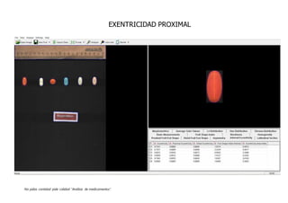 No pidas cantidad pide calidad “Análisis de medicamentos”.
EXENTRICIDAD PROXIMAL
 