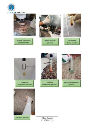 10. ANEXOS:
Edgar Basantes
CI 0705812253
Viseras en remojo
con cloroformo
Realizando las
pruebas
Prueba de
Dunas positiva
Prueba de
Lustgarten positiva
Prueba de
Roseboom positiva
Prueba de Benedict
positiva
Ensayoa laLlama
 