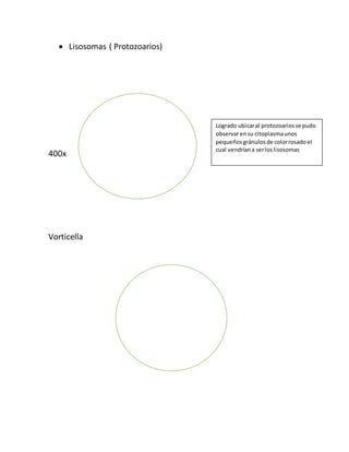  Lisosomas ( Protozoarios) 
400x 
Vorticella 
Logrado ubicar al protozoarios se pudo 
observar en su citoplasma unos 
pequeños gránulos de color rosado el 
cual vendrían a ser los lisosomas 
 