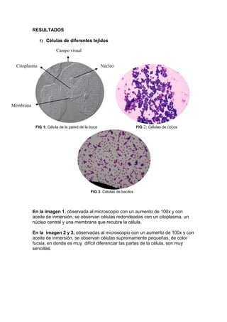 RESULTADOS
1) Células de diferentes tejidos
FIG 1: Célula de la pared de la boca FIG 2: Células de cocos
FIG 3: Células de bacilos
En la imagen 1, observada al microscopio con un aumento de 100x y con
aceite de inmersión, se observan células redondeadas con un citoplasma, un
núcleo central y una membrana que recubre la célula.
En la imagen 2 y 3, observadas al microscopio con un aumento de 100x y con
aceite de inmersión, se observan células supremamente pequeñas, de color
fucsia, en donde es muy difícil diferenciar las partes de la célula, son muy
sencillas.
NúcleoCitoplasma
Membrana
Campo visual
 