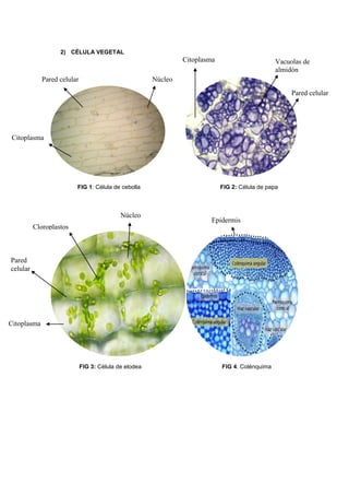 2) CÉLULA VEGETAL
FIG 1: Célula de cebolla FIG 2: Célula de papa
FIG 3: Célula de elodea FIG 4: Colénquima
NúcleoPared celular
Citoplasma
Vacuolas de
almidón
Pared celular
Citoplasma
Cloroplastos
Pared
celular
Citoplasma
Núcleo
Epidermis
 