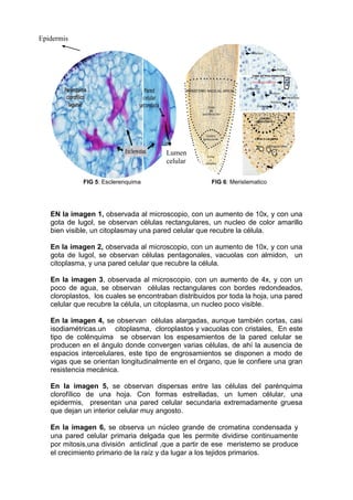 FIG 5: Esclerenquima FIG 6: Meristematico
EN la imagen 1, observada al microscopio, con un aumento de 10x, y con una
gota de lugol, se observan células rectangulares, un nucleo de color amarillo
bien visible, un citoplasmay una pared celular que recubre la célula.
En la imagen 2, observada al microscopio, con un aumento de 10x, y con una
gota de lugol, se observan células pentagonales, vacuolas con almidon, un
citoplasma, y una pared celular que recubre la célula.
En la imagen 3, observada al microscopio, con un aumento de 4x, y con un
poco de agua, se observan células rectangulares con bordes redondeados,
cloroplastos, los cuales se encontraban distribuidos por toda la hoja, una pared
celular que recubre la célula, un citoplasma, un nucleo poco visible.
En la imagen 4, se observan células alargadas, aunque también cortas, casi
isodiamétricas.un citoplasma, cloroplastos y vacuolas con cristales, En este
tipo de colénquima se observan los espesamientos de la pared celular se
producen en el ángulo donde convergen varias células, de ahí la ausencia de
espacios intercelulares, este tipo de engrosamientos se disponen a modo de
vigas que se orientan longitudinalmente en el órgano, que le confiere una gran
resistencia mecánica.
En la imagen 5, se observan dispersas entre las células del parénquima
clorofílico de una hoja. Con formas estrelladas, un lumen célular, una
epidermis, presentan una pared celular secundaria extremadamente gruesa
que dejan un interior celular muy angosto.
En la imagen 6, se observa un núcleo grande de cromatina condensada y
una pared celular primaria delgada que les permite dividirse continuamente
por mitosis,una división anticlinal ,que a partir de ese meristemo se produce
el crecimiento primario de la raíz y da lugar a los tejidos primarios.
Epidermis
Lumen
celular
 