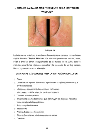 ¿CUÁL ES LA CAUSA MÁS FRECUENTE DE LA IRRITACIÓN
VAGINAL?

FIGURA. 10
La irritación de la vulva y la vagina es frecuentemente causada por un hongo
vaginal llamado Cándida Albicans. Los síntomas pueden ser picazón, ardor,
dolor o ardor al orinar, enrojecimiento de la mucosa de la vulva, dolor o
molestias durante las relaciones sexuales y la presencia de un flujo espeso,
blanco y grumoso parecido a la ricota.
LAS CAUSAS MÁS COMUNES PARA LA IRRITACIÓN VAGINAL SON:
o Stress
o Utilización de agentes demasiado agresivos en la higiene personal o que
producen alergias.
o Infecciones sexualmente transmisibles no tratadas
Infecciones por HPV (virus del papiloma humano)
o Diabetes mal compensada.
o Tratamiento con medicamentos que disminuyen las defensas naturales,
como por ejemplo los corticoides
o Anticoncepción hormonal
o Tabaquismo
o Anemia, bajo peso, desnutrición
o Otras enfermedades crónicas descompensadas
o Obesidad

35

 