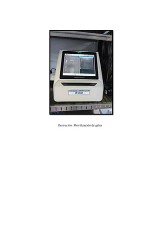 Ilustración. Movilización de geles
 