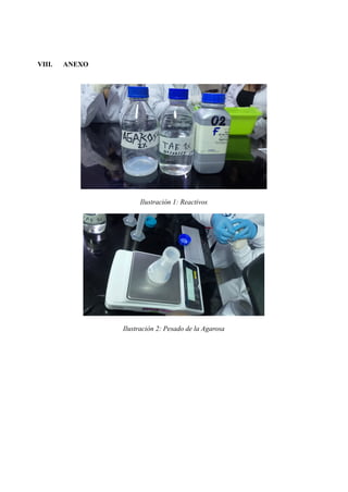 VIII. ANEXO
Ilustración 1: Reactivos
Ilustración 2: Pesado de la Agarosa
 