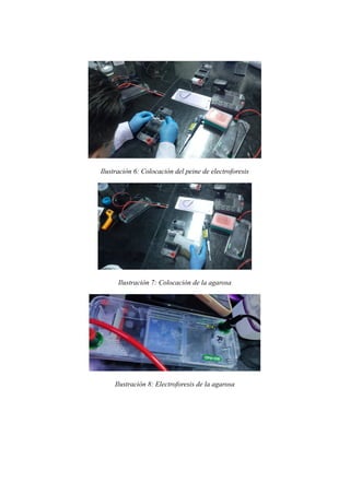 Ilustración 6: Colocación del peine de electroforesis
Ilustración 7: Colocación de la agarosa
Ilustración 8: Electroforesis de la agarosa
 