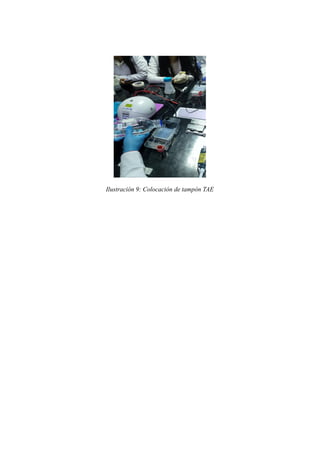 Ilustración 9: Colocación de tampón TAE
 