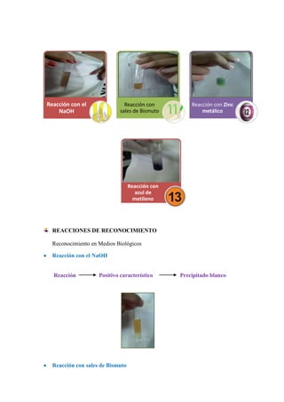 Reacción con el
NaOH

Reacción con
sales de Bismuto

Reacción con Zinc
metálico

Reacción con
azul de
metileno

REACCIONES DE RECONOCIMIENTO
Reconocimiento en Medios Biológicos
Reacción con el NaOH

Reacción

Positivo característico

Reacción con sales de Bismuto

Precipitado blanco

 