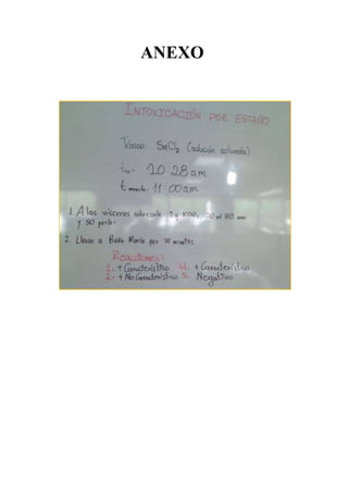 ANEXO

 