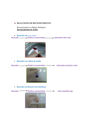 REACCIONES DE RECONOCIMIENTO
Reconocimiento en Medios Biológicos
Reconocimientos de Ácidos
Reacción con rojo congo
Reacción
Positivo característico

coloración color azul.

Reacción con violeta de metilo
Reacción

Positivo característico

coloración azul-gris-verde.

Reacción con Reactivo de Gunzburg
Reacción

Positivo característico

color amarillo rojo.

 