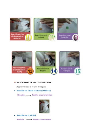 Reacción con los
álcalis cáusticos
(COBAYO)

Reacción con el
NH4OH

Reacción con los
álcalis cáusticos
(RATA)

Reacción con el
NH4OH

REACCIONES DE RECONOCIMIENTO
Reconocimiento en Medios Biológicos
Reacción con álcalis cáusticos (COBAYO)
Reacción

Positivo no característico

Reacción con el NH4OH
Reacción

Positivo característico

Reacción con el
Fe(CH)6K4

Reacción con el
Fe(CH)6K4

 