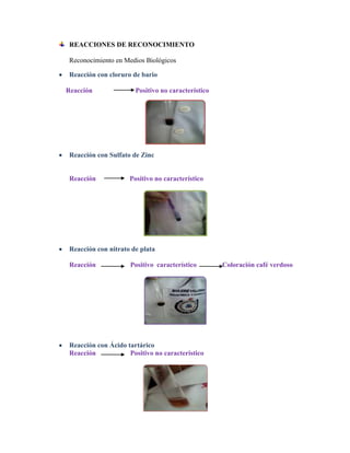 REACCIONES DE RECONOCIMIENTO
Reconocimiento en Medios Biológicos
Reacción con cloruro de bario
Reacción

Positivo no característico

Reacción con Sulfato de Zinc

Reacción

Positivo no característico

Reacción con nitrato de plata
Reacción

Positivo característico

Reacción con Ácido tartárico
Reacción
Positivo no característico

Coloración café verdoso

 