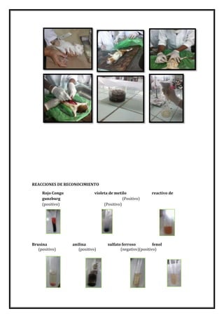 REACCIONES DE RECONOCIMIENTO
Rojo Congo
gunzburg
(positivo)

Brusina
(positivo)

violeta de metilo
(Positivo)
(Positivo)

anilina
(positivo)

reactivo de

sulfato ferroso
fenol
(negativo)(positivo)

 
