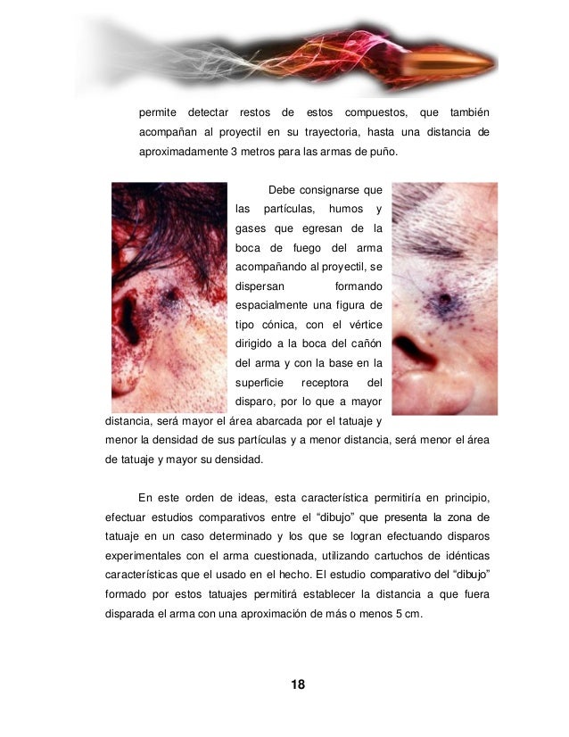 Informe (Tema 4) Heridas causadas por armas de fuego. Informe (Tema 4) Heridas causadas por armas de fuego.