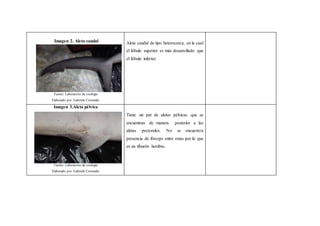 Imagen 2. Aleta caudal
Fuente: Laboratorio de zoología
Elaborado por: Gabriela Coronado
Aleta caudal de tipo heterocerca, en la cual
el lóbulo superior es más desarrollado que
el lóbulo inferior.
Imagen 3.Aleta pélvica
Fuente: Laboratorio de zoología
Elaborado por: Gabriela Coronado
Tiene un par de aletas pélvicas que se
encuentran de manera posterior a las
aletas pectorales. No se encuentra
presencia de fórceps entre estas por lo que
es un tiburón hembra.
 