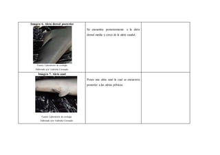 Imagen 6. Aleta dorsal posterior
Fuente: Laboratorio de zoología
Elaborado por: Gabriela Coronado
Se encuentra posteriormente a la aleta
dorsal media y cerca de la aleta caudal.
Imagen 7. Aleta anal
Fuente: Laboratorio de zoología
Elaborado por: Gabriela Coronado
Posee una aleta anal la cual se encuentra
posterior a las aletas pélvicas.
 
