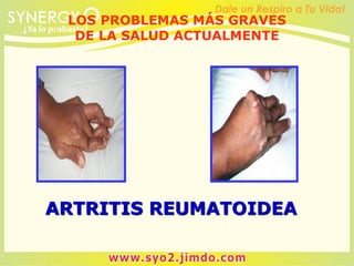 ARTRITIS REUMATOIDEA
LOS PROBLEMAS MÁS GRAVES
DE LA SALUD ACTUALMENTE
 