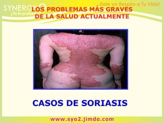CASOS DE SORIASIS
LOS PROBLEMAS MÁS GRAVES
DE LA SALUD ACTUALMENTE
 