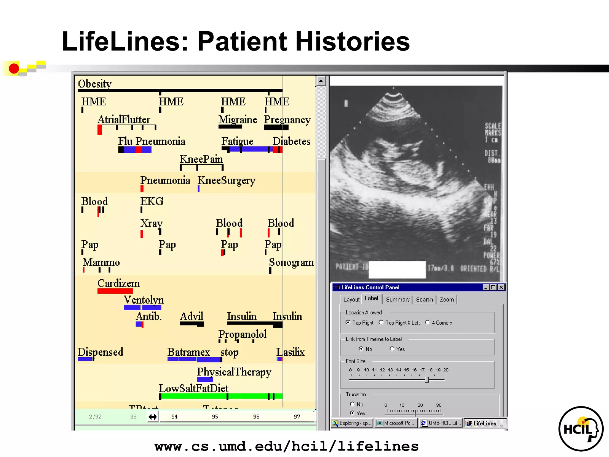 LifeLines: Patient Histories




       www.cs.umd.edu/hcil/lifelines
 