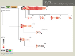 HemoVis
hFp://people.seas.harvard.edu/~borkin/HemoVis/	
  
 
