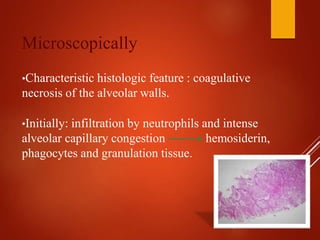 Microscopically
•Characteristic histologic feature : coagulative
necrosis of the alveolar walls.
•Initially: infiltration by neutrophils and intense
alveolar capillary congestion hemosiderin,
phagocytes and granulation tissue.
 