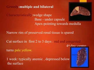 Grossly:multiple and bilateral
Characteristically:wedge shape
Base - under capsule
Apex-pointing towards medulla
Narrow rim of preserved renal tissue is spared
Cut surface in first 2 to 3 days : red and congested
4th day: centre
turns pale yellow.
1 week: typically anemic , depressed below
the surface
 