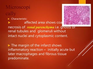 Microscopi
cally
 Characteristic:
 affected area shows coagulative
necrosis of renal parenchyma i.e. ghosts of
renal tubules and glomeruli without
intact nuclei and cytoplasmic content.
 The margin of the infarct shows
inflammatory reaction – initially acute but
later macrophages and fibrous tissue
predominate.
 