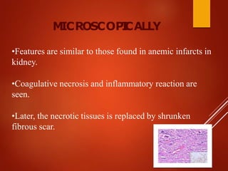 •Features are similar to those found in anemic infarcts in
kidney.
•Coagulative necrosis and inflammatory reaction are
seen.
•Later, the necrotic tissues is replaced by shrunken
fibrous scar.
M
ICROSCOPI
CALLY
 