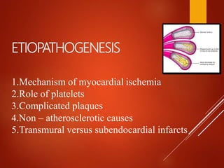 ETIOPATHOGENESIS
1.Mechanism of myocardial ischemia
2.Role of platelets
3.Complicated plaques
4.Non – atherosclerotic causes
5.Transmural versus subendocardial infarcts
 
