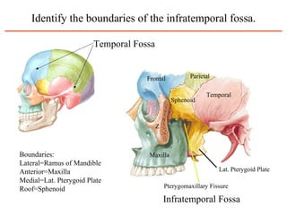 Identify the boundaries of the infratemporal fossa. Boundaries: Lateral=Ramus of Mandible Anterior=Maxilla Medial=Lat. Pterygoid Plate Roof=Sphenoid Temporal Fossa Temporal Maxilla Parietal Sphenoid Frontal Z Lat. Pterygoid Plate Pterygomaxillary Fissure Infratemporal Fossa 