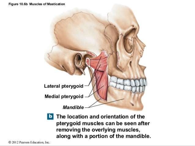 infratemporal fossa