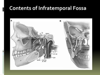 Contents of Infratemporal Fossa
 