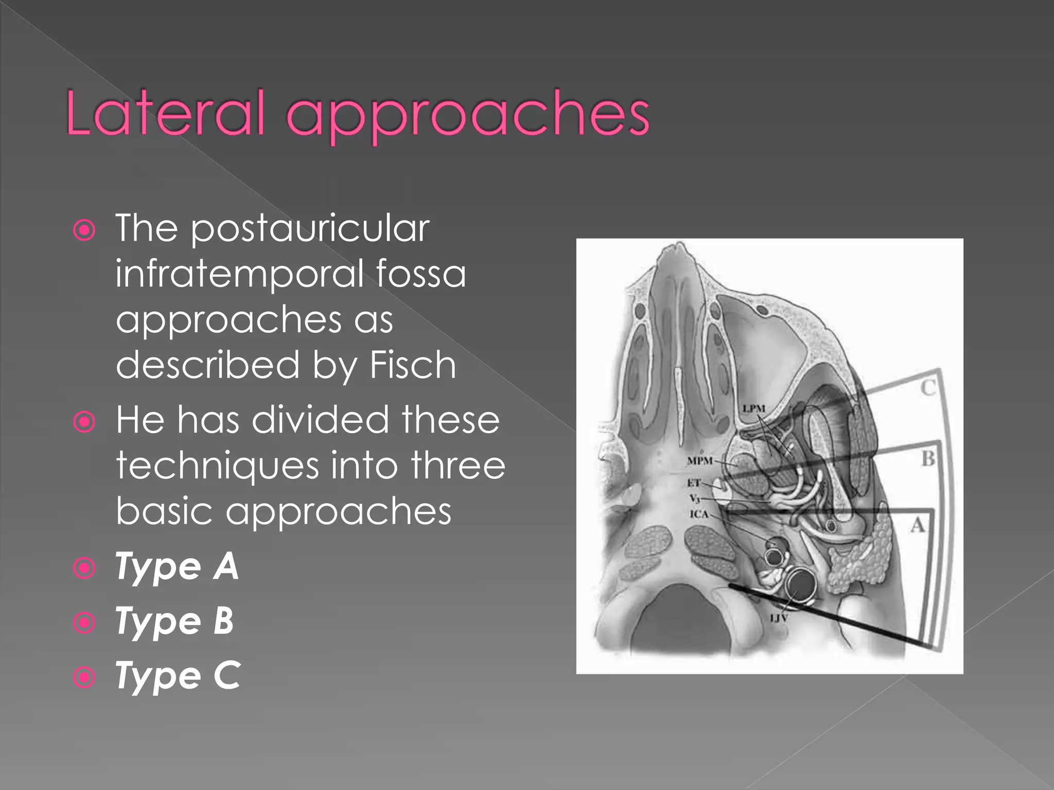  The postauricular
infratemporal fossa
approaches as
described by Fisch
 He has divided these
techniques into three
basic approaches
 Type A
 Type B
 Type C
 