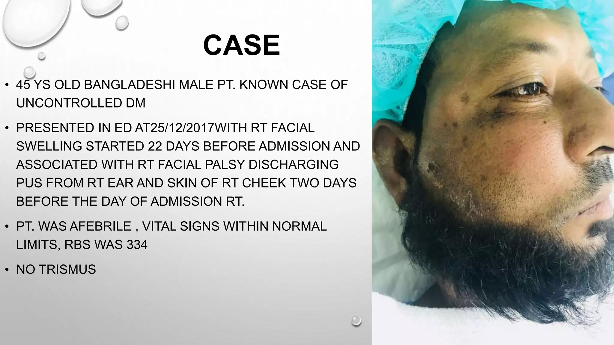 CASE
• 45 YS OLD BANGLADESHI MALE PT. KNOWN CASE OF
UNCONTROLLED DM
• PRESENTED IN ED AT25/12/2017WITH RT FACIAL
SWELLING STARTED 22 DAYS BEFORE ADMISSION AND
ASSOCIATED WITH RT FACIAL PALSY DISCHARGING
PUS FROM RT EAR AND SKIN OF RT CHEEK TWO DAYS
BEFORE THE DAY OF ADMISSION RT.
• PT. WAS AFEBRILE , VITAL SIGNS WITHIN NORMAL
LIMITS, RBS WAS 334
• NO TRISMUS
 
