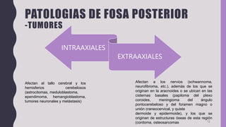 PATOLOGIAS DE FOSA POSTERIOR
-TUMORES
INTRAAXIALES
EXTRAAXIALES
12
Afectan al tallo cerebral y los
hemisferios cerebelosos
(astrocitomas, meduloblastoma,
ependimoma, hemangioblastoma,
tumores neuronales y metástasis)
Afectan a los nervios (schwannoma,
neurofibroma, etc.), además de los que se
originan en la aracnoides o se ubican en las
cisternas basales (papiloma del plexo
coroides, meningioma del ángulo
pontocerebeloso y del foramen magno o
unión craneocervical, y quiste
dermoide y epidermoide), y los que se
originan de estructuras óseas de esta región
(cordoma, osteosarcomas
 