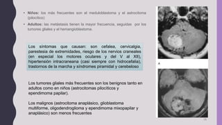 • Niños: los más frecuentes son el meduloblastoma y el astrocitoma
(pilocítico)
• Adultos: las metástasis tienen la mayor frecuencia, seguidas por los
tumores gliales y el hemangioblastoma.
13
Los síntomas que causan: son cefalea, cervicalgia,
parestesia de extremidades, riesgo de los nervios craneales
(en especial los motores oculares y del V al XII),
hipertensión intracraneana (casi siempre con hidrocefalia),
trastornos de la marcha y síndromes piramidal y cerebeloso
Los tumores gliales más frecuentes son los benignos tanto en
adultos como en niños (astrocitomas pilocíticos y
ependimoma papilar).
Los malignos (astrocitoma anaplásico, glioblastoma
multiforme, oligodendroglioma y ependimoma mixopapilar y
anaplásico) son menos frecuentes
 