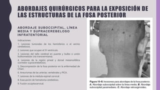 ABORDAJES QUIRÚRGICOS PARA LA EXPOSICIÓN DE
LAS ESTRUCTURAS DE LA FOSA POSTERIOR
ABORDAJE SUBOCCIPITAL, LÍNEA
MEDIA Y SUPRACEREBELOSO
INFRATENTORIAL
Indicaciones:
1. Lesiones tumorales de los hemisferios o el vermis
cerebelosos.
2. Lesiones que ocupan el IV ventrículo.
3. Lesiones del tallo cerebral en puente y bulbo o unión
bulbomedular (vía transvermiana).
4. Lesiones de la región pineal y dorsal mesencefálica
(corredor supracerebeloso).
5. Descompresión de la fosa posterior en la enfermedad de
Chiari.
6. Aneurismas de las arterias: vertebrales y PICA.
7. Lesiones de la médula espinal cervical.
8. Evacuación de hematoma cerebeloso.
9. Fusión occipitocervical.
ABORDAJE SUBOCCIPITAL
PARAMEDIANO Y EXTREMO
LATERAL
• Indicaciones:
• 1. Lesiones tumorales del hemisferio que se aborda.
• 2. Lesiones del ángulo pontocerebeloso.
• 3. Meningiomas laterales del tentorio.
• 4. Lesiones anterolaterales del tallo cerebral.
• 5. Lesiones del foramen magno lateral o anterior.
• 6. Lesiones del clivus.
• 7. Aneurismas de la arteria basilarmedia o baja, y de
• la arteria vertebral o PICA.
16
 