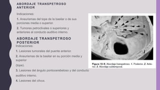 Indicaciones:
1. Aneurismas del tope de la basilar o de sus
porciones media o superior.
2. Tumores petroclivales o superiores y
anteriores al conducto auditivo interno.
ABORDAJE TRANSPETROSO
POSTERIOR
Indicaciones:
1. Lesiones tumorales del puente anterior.
2. Aneurismas de la basilar en su porción media y
superior
(tope).
3. Lesiones del ángulo pontocerebeloso y del conducto
auditivo interno.
4. Lesiones del clivus.
ABORDAJE TRANSPETROSO
ANTERIOR
 
