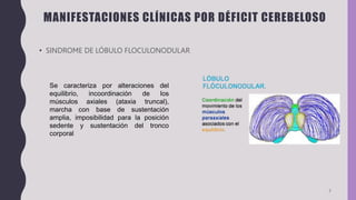 7
MANIFESTACIONES CLÍNICAS POR DÉFICIT CEREBELOSO
Se caracteriza por alteraciones del
equilibrio, incoordinación de los
músculos axiales (ataxia truncal),
marcha con base de sustentación
amplia, imposibilidad para la posición
sedente y sustentación del tronco
corporal
• SINDROME DE LÓBULO FLOCULONODULAR
 
