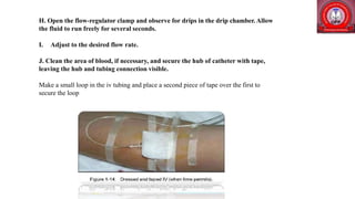 infusion.pptx