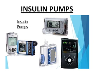 INSULIN PUMPS
 