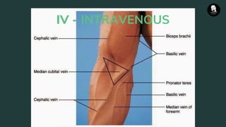 IV - INTRAVENOUS
 