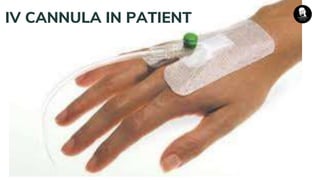 IV CANNULA IN PATIENT
 