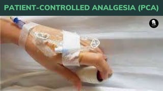 PATIENT-CONTROLLED ANALGESIA (PCA)
 